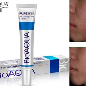 Bioaqua Anti Acne Scar Mark Removal Cream