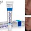 100pcs FREE DHL BIOAQUA Acne Cream Light Print Scar Removal Face Cream ure Skin Care Whitening 1