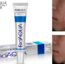 100pcs FREE DHL BIOAQUA Acne Cream Light Print Scar Removal Face Cream ure Skin Care Whitening 1