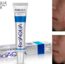 Bioaqua Anti Acne Scar Mark Removal Cream