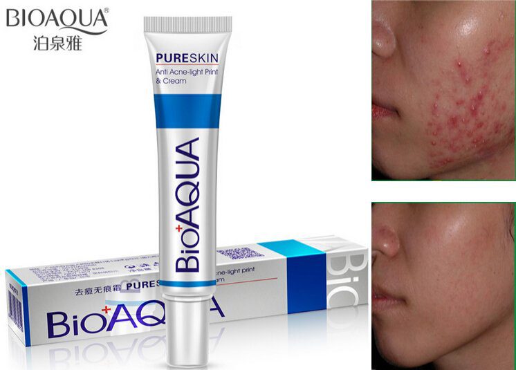 100pcs FREE DHL BIOAQUA Acne Cream Light Print Scar Removal Face Cream ure Skin Care Whitening 1