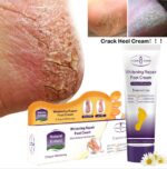 Aichun Crack Heel Cream Repair Anti Crack Whitening Cream Foot Peeling Cracked Hands Feet Dry Skin Moisturizing Foot Care