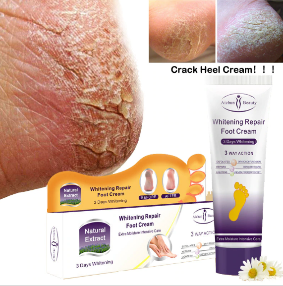 Aichun Crack Heel Cream Repair Anti Crack Whitening Cream Foot Peeling Cracked Hands Feet Dry Skin Moisturizing Foot Care