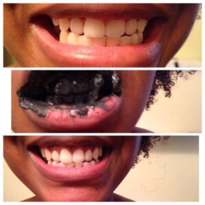 Bamboo Charcoal Teeth Whitener Toothpaste
