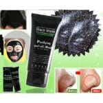 black head remover black mask