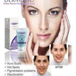 dermonu acne removal cream1