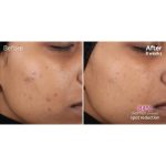 Buy the Best Quality Ponds Flawless Radiance Mattifying Day Cream at the Best Price in Pakistan at Getnow.pk . Most Affordable Price With Fast Shipping All Over Pakistan 10